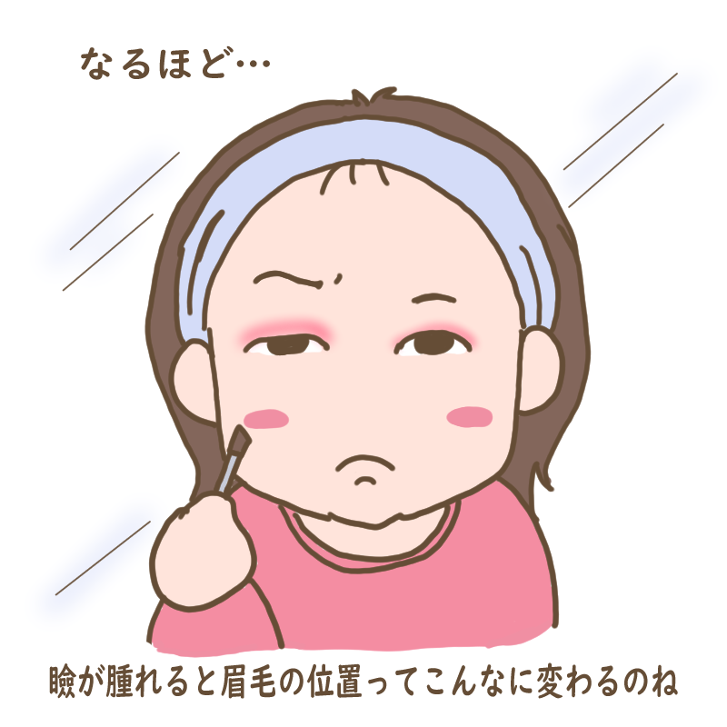 瞼が腫れると眉毛の位置が変わることを発見するわたし