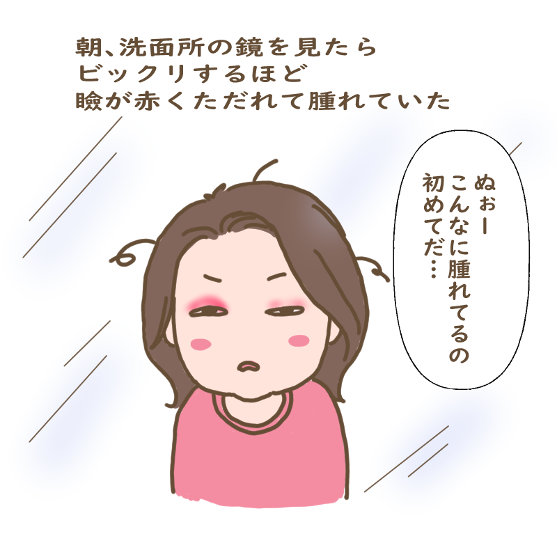 朝、鏡を見たらビックリするほど瞼が赤くただれて腫れていた